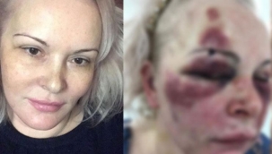 Sosyal medyada tanıştığı kişi otel odasında kabusu yaşattı! Kanlar bulaşınca tadı ne güzel diyordu