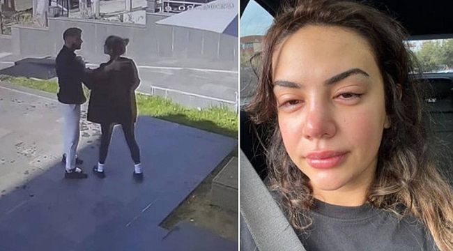 Ece Ronay, boşandığı Bilir'den şiddet gördüğü görüntüleri paylaştı: "Ölümle tehdit ediliyorum"